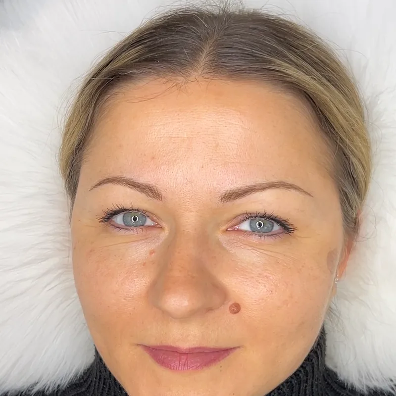 Nachher: Ergebnis, Form und Farbe auf das Gesicht abgestimmt