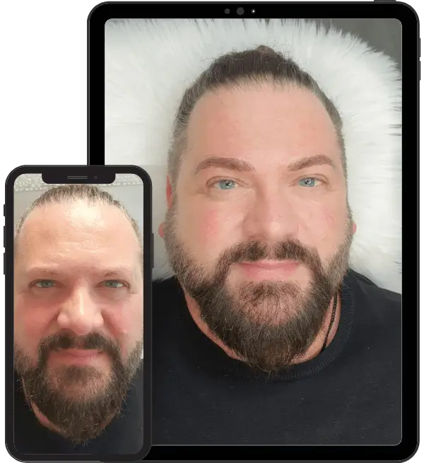 Permanent Make-up Männer vorher nachher