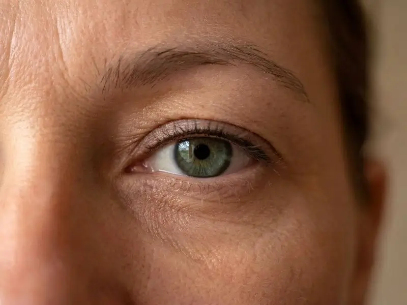 Augen mit Schlupflidern nach der Wimpernkranzverdichtung – natürlich wacher Blick