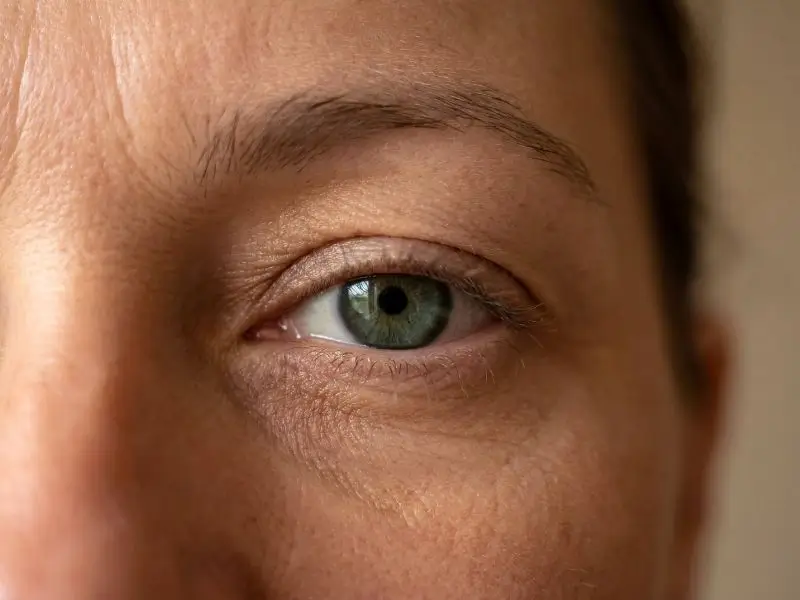 Augen mit Schlupflidern vor der Wimpernkranzverdichtung – ohne Permanent Make-up